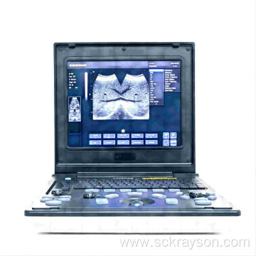 Male gallstone ultrasound diagnosis instrument